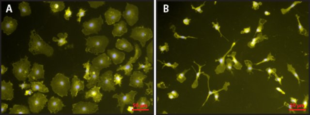 Lipopolysaccharide-LPS from Ecoli 0111:B4, TLR4 ligand Lipopolysaccharide-LPS from Ecoli 0111:B4, TLR4 ligand